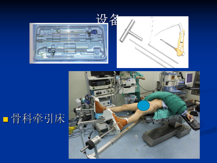 髋关节镜技术在髋关节疾病的应用课件.ppt_第3页