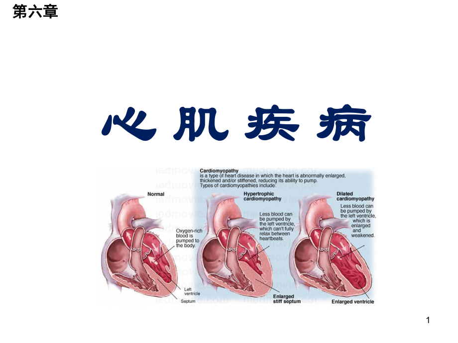 心肌疾病PPT课件.pptx_第1页