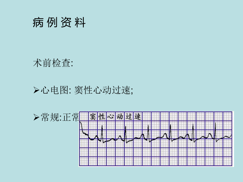 产科病例讨论完美版课件.ppt_第3页