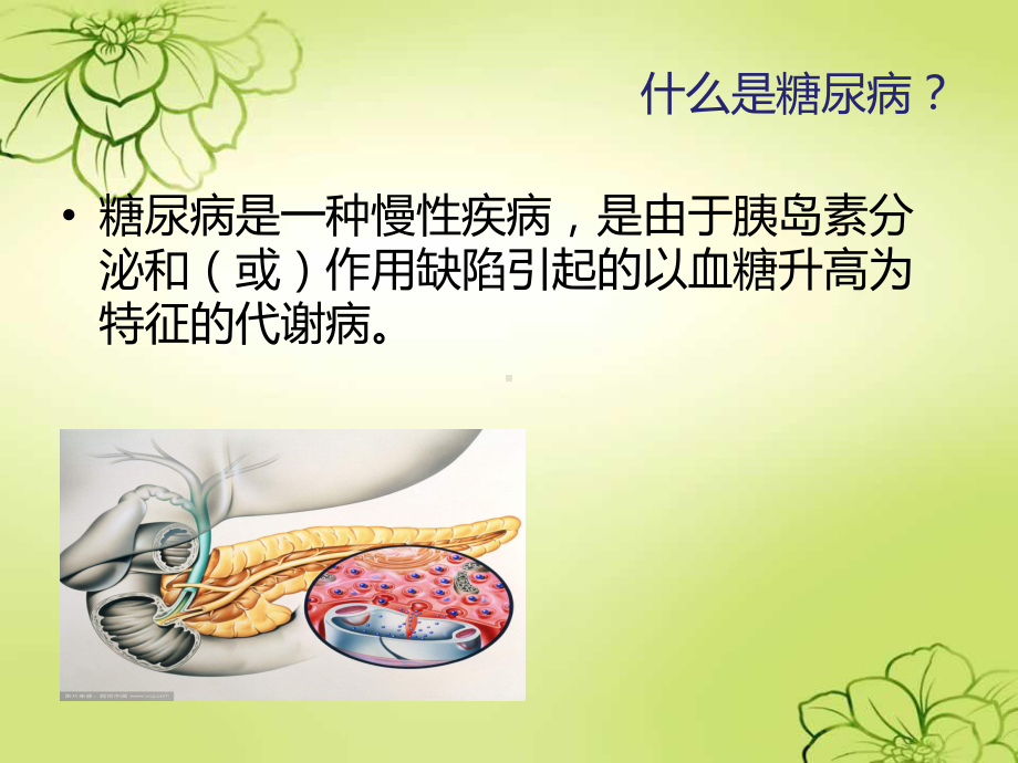 糖尿病健康宣教课件.ppt_第2页