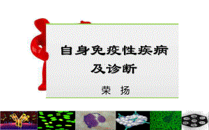 自身免疫性疾病及诊断ppt课件.ppt