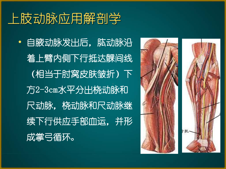 经桡动脉穿刺及并发症处理课件.pptx_第2页