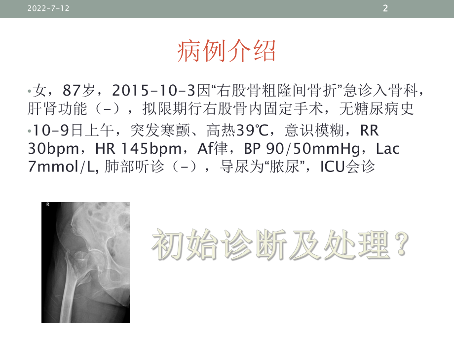 泌尿系脓毒症的诊疗和治疗PPT培训课件.ppt_第2页