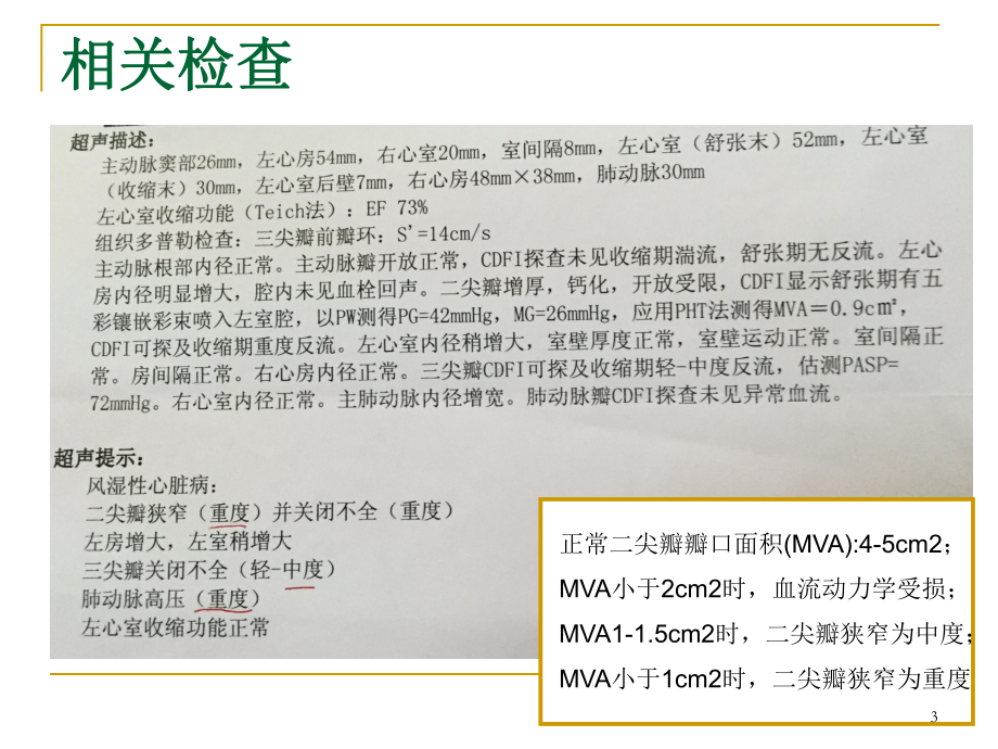 二尖瓣狭窄病例讨论PPT课件.ppt_第3页