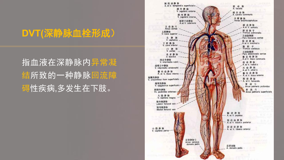 深静脉血栓形成的预防及护理PPT课件.ppt_第2页