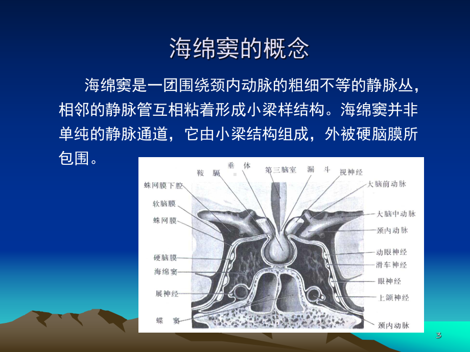 海绵窦栓塞ppt课件.ppt_第3页