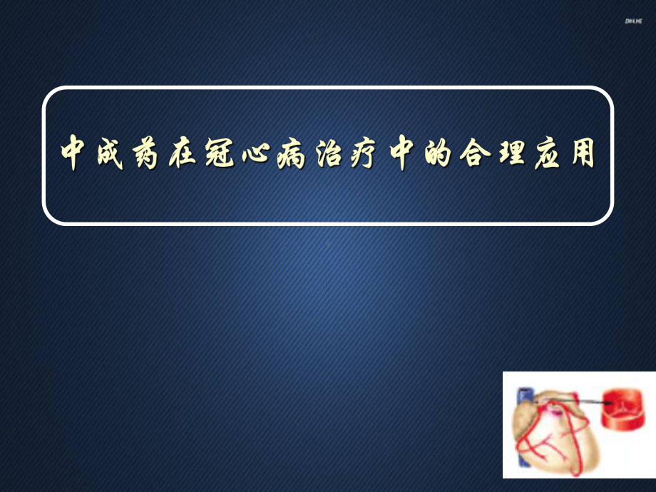 中成药在冠心病治疗中的合理应用-ppt课件.ppt_第2页