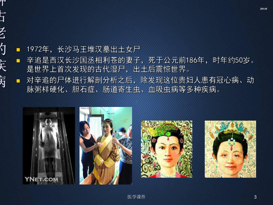 中成药在冠心病治疗中的合理应用-ppt课件.ppt_第3页