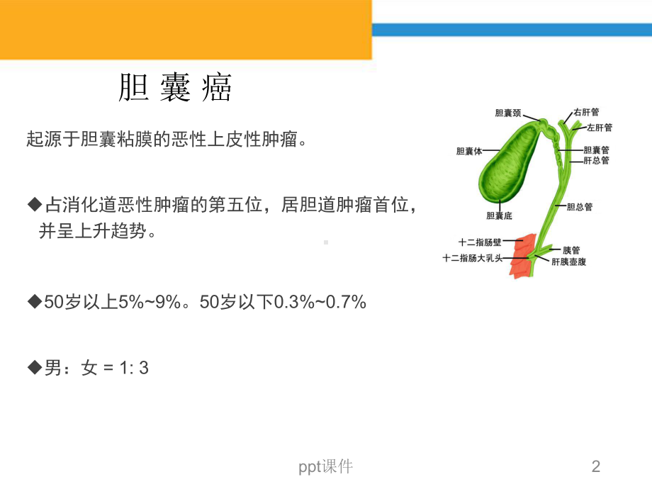 胆囊癌CT诊断-ppt课件.ppt_第2页