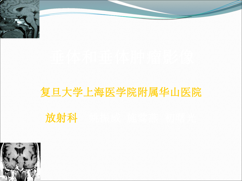 垂体和垂体肿瘤影像课件.ppt_第1页