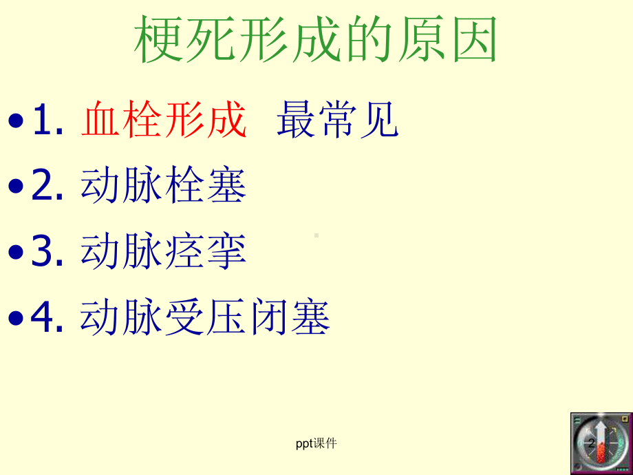 《病理学》梗死-ppt课件.ppt_第2页