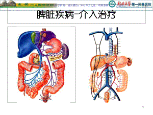 脾脏的介入栓塞治疗课件.ppt