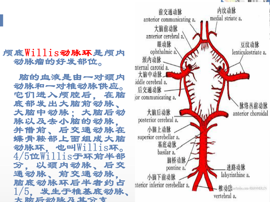 动脉瘤病人护理查房-ppt课件.ppt_第3页