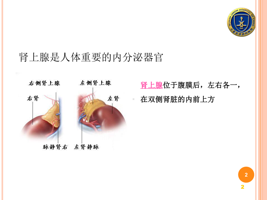 肾上腺手术的麻醉PPT课件.ppt_第2页