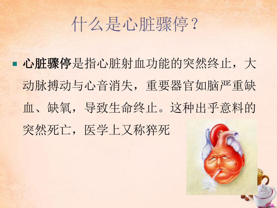 术中患者心脏骤停应急预案课件.ppt_第2页