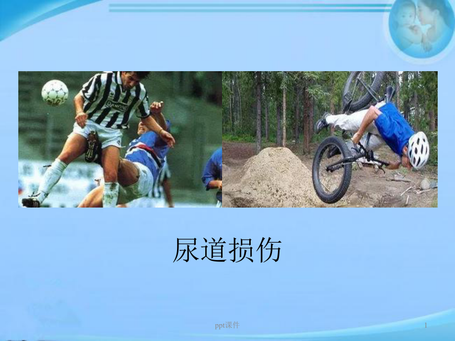 尿道损伤的诊断-ppt课件.ppt_第1页