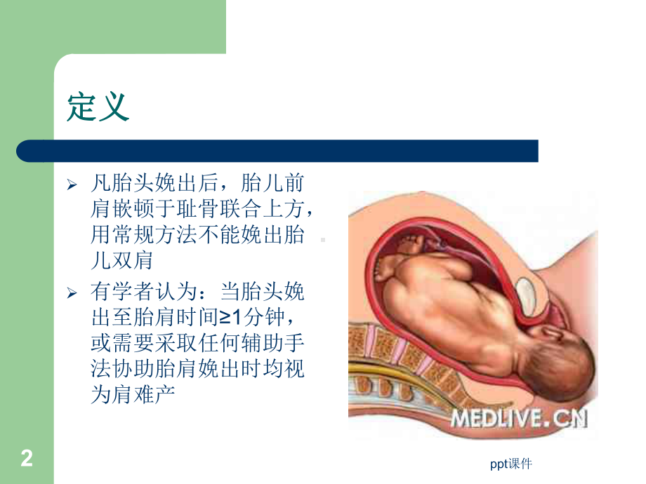 肩难产处理流程-ppt课件.ppt_第2页