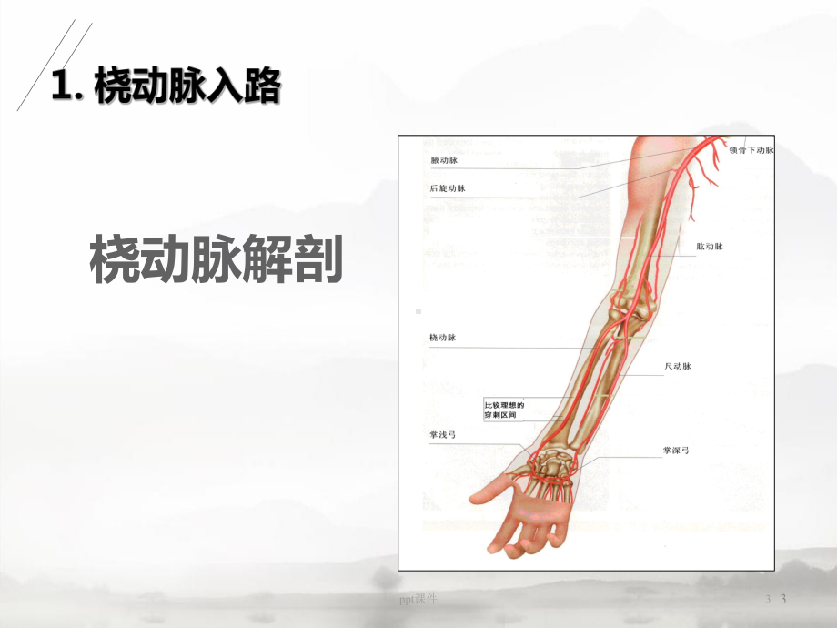 介入治疗入路与止血-ppt课件.ppt_第3页