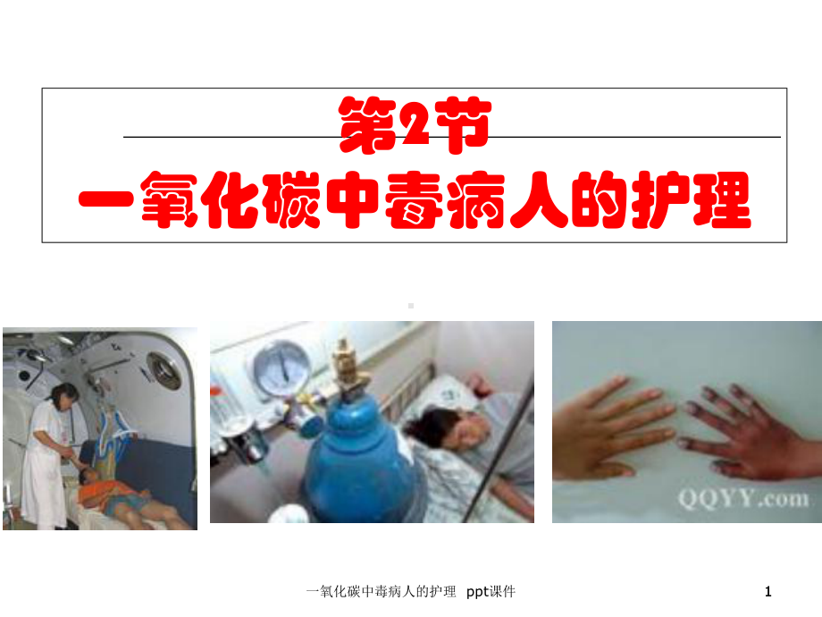 一氧化碳中毒病人的护理-ppt课件(同名98).ppt_第1页