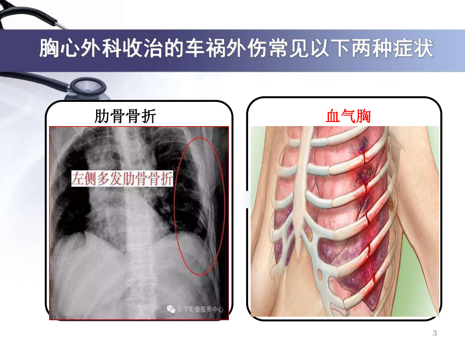 胸腔闭式引流术PPT课件1.ppt_第3页