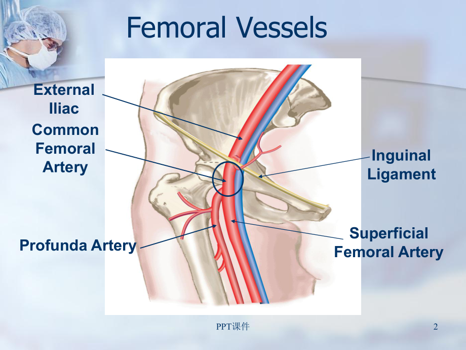 股动脉封堵器-ppt课件.ppt_第2页