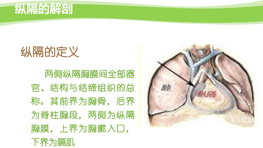 纵隔肿瘤PPT课件.ppt_第3页