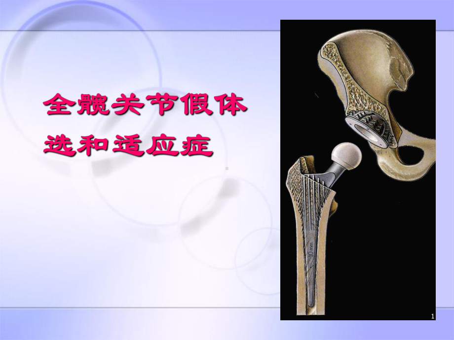 全髋关节假体选和适应症PPT课件.ppt_第1页