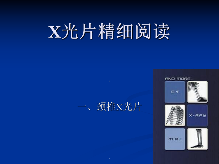 颈椎X光片阅读课件.ppt_第1页