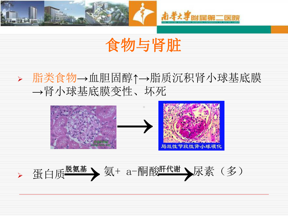 肾移植的饮食指导教学内容课件.ppt_第3页