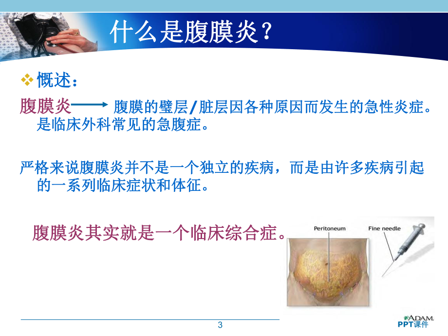 急性腹膜炎-ppt课件.ppt_第3页