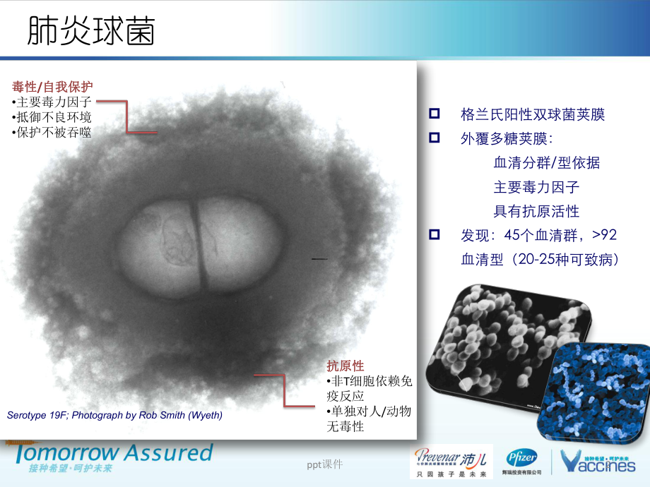 肺炎球菌疾病概述-ppt课件.pptx_第2页