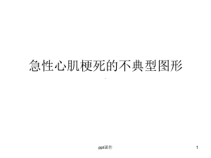 急性心肌梗死不典型图形-ppt课件.ppt