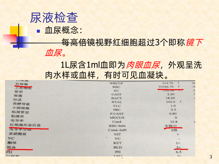 肾内科知识-ppt课件.ppt_第3页