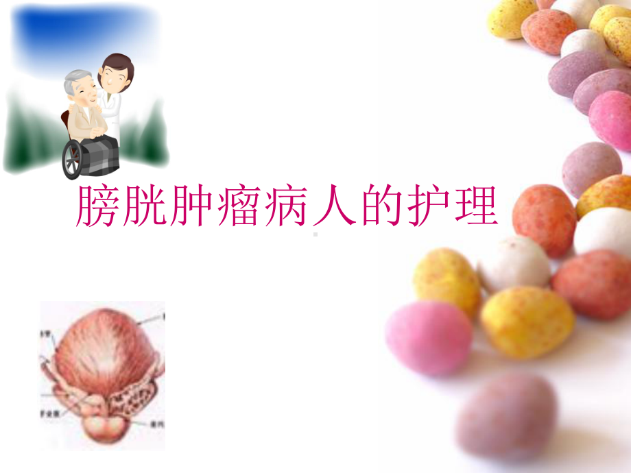 膀胱肿瘤病人的护理PPT课件1.ppt_第1页