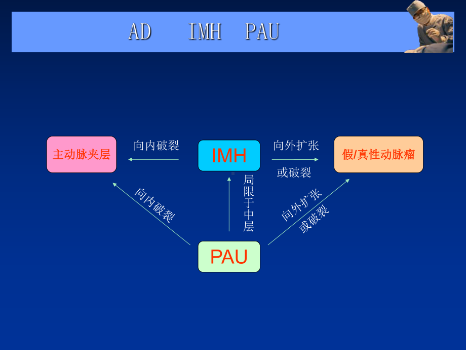 主动脉夹层、壁内血肿及穿透溃疡课件.ppt_第3页