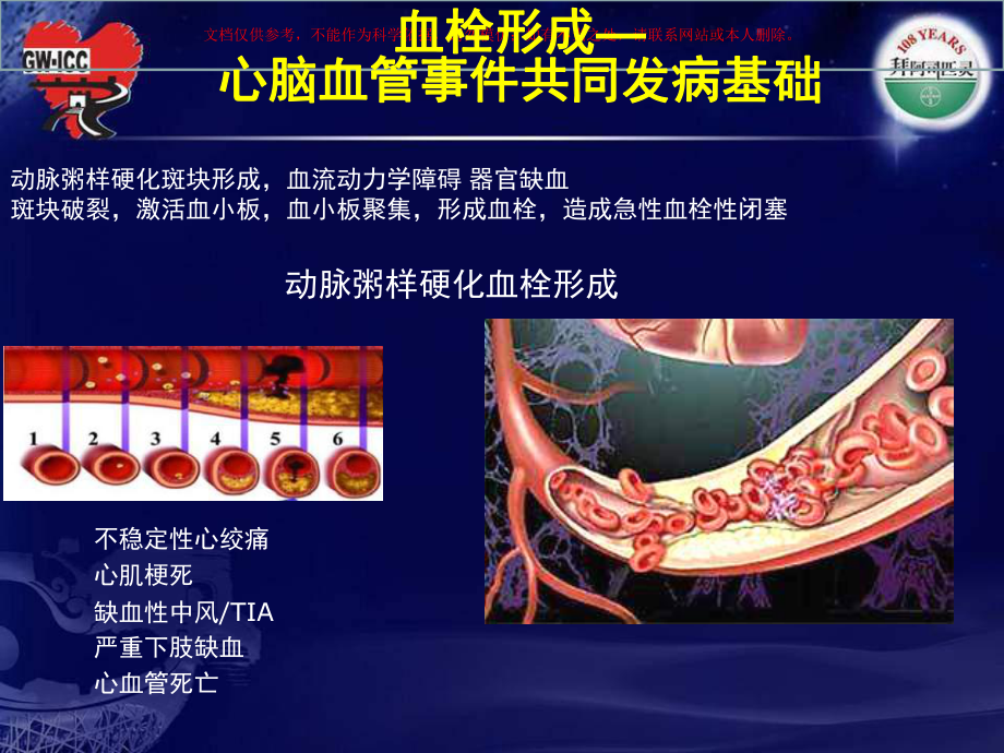 从指南看糖尿病抗血小板治疗培训课件.ppt_第2页