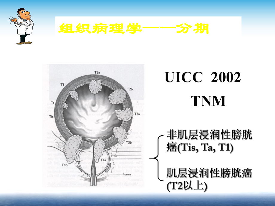 膀胱癌化疗课件.ppt_第3页