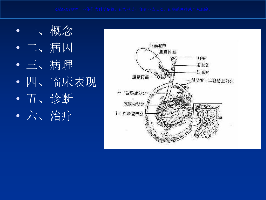 急性梗阻性化脓性胆管炎课件(同名170).ppt_第1页