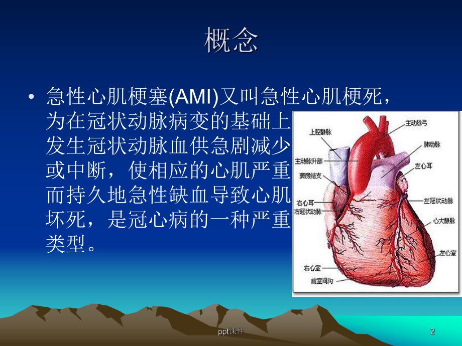 急性心肌梗死的护理措施-ppt课件.ppt_第2页