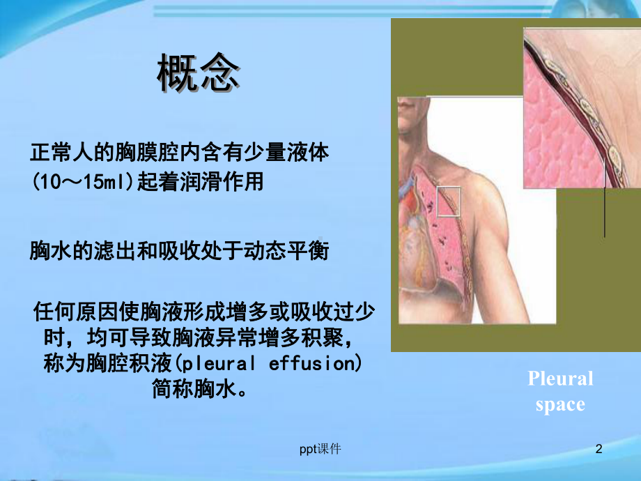 胸腔积液护理-ppt课件.ppt_第2页