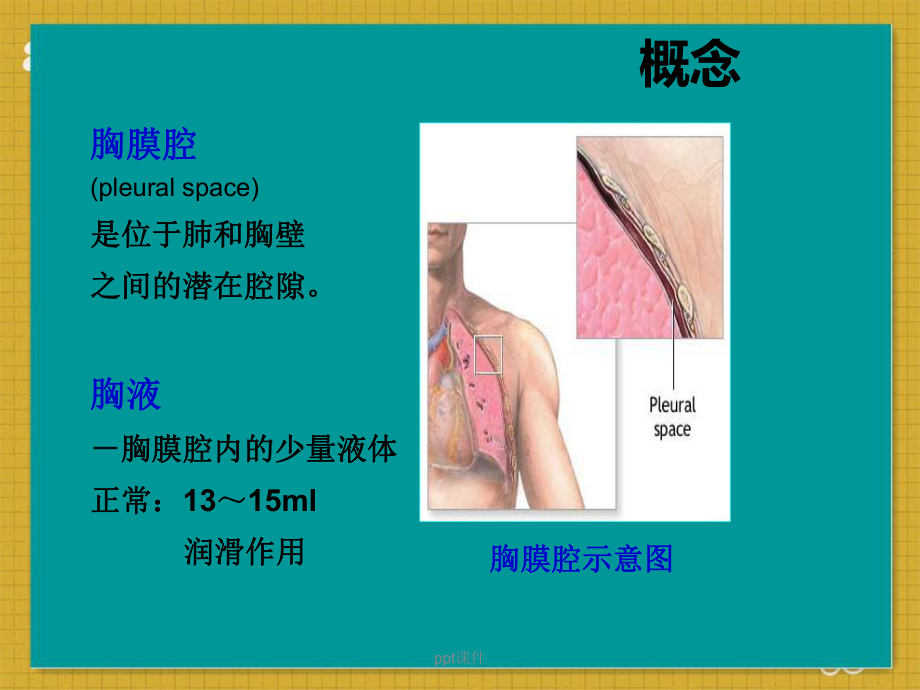 胸腔积液患者的护理-ppt课件1.ppt_第3页