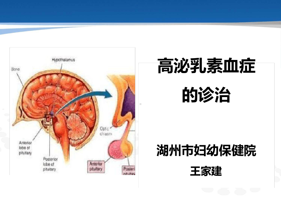 高泌乳素血症治疗课件.ppt_第1页