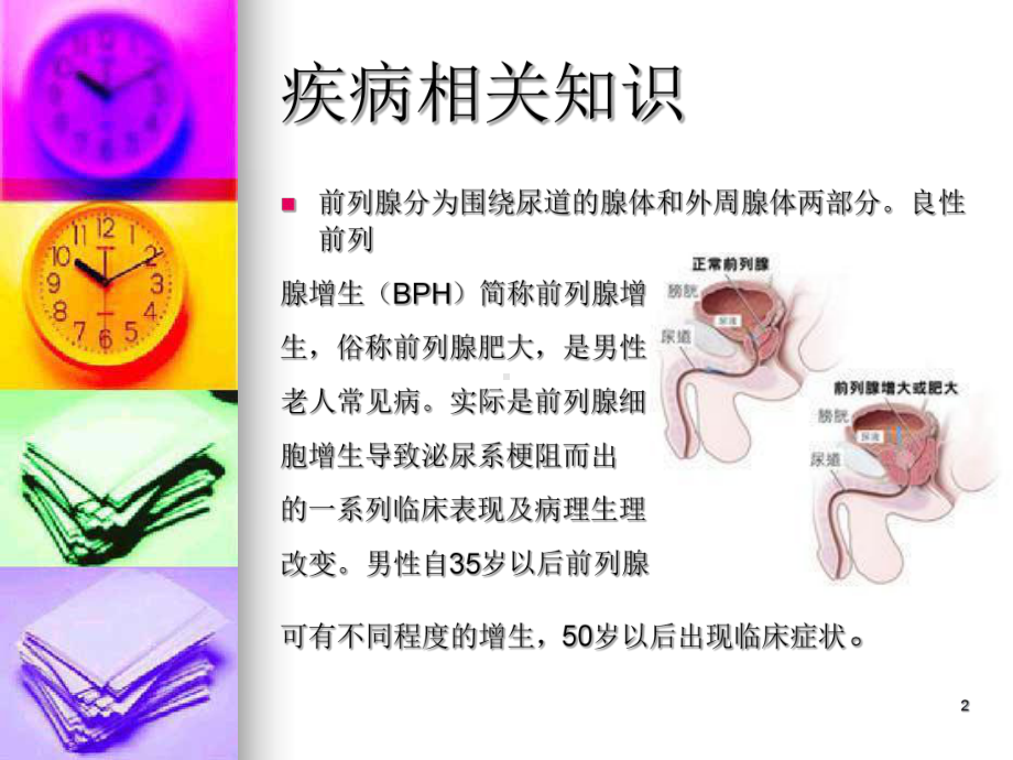 前列腺增生的术前术后护理PPT课件.ppt_第2页