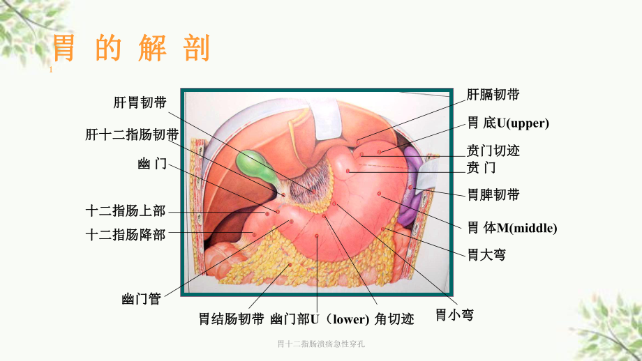 胃十二指肠溃疡急性穿孔课件.ppt_第2页