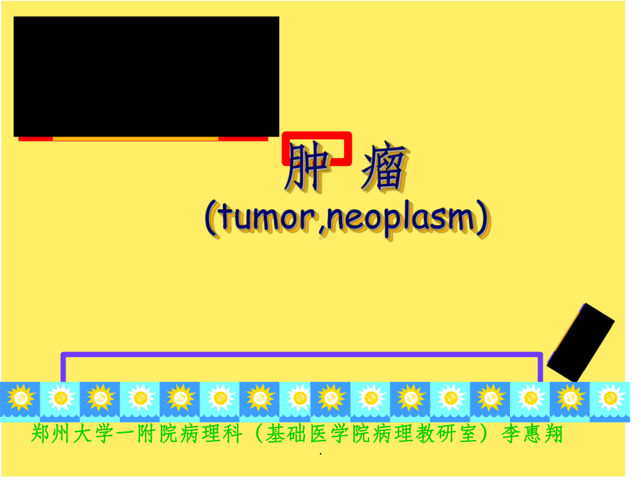 肿瘤简单介绍课件.ppt_第1页