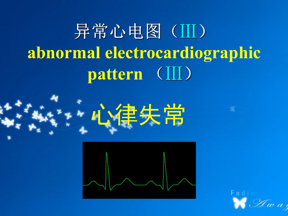 异常心电图-心律失常-PPT课件.ppt_第1页