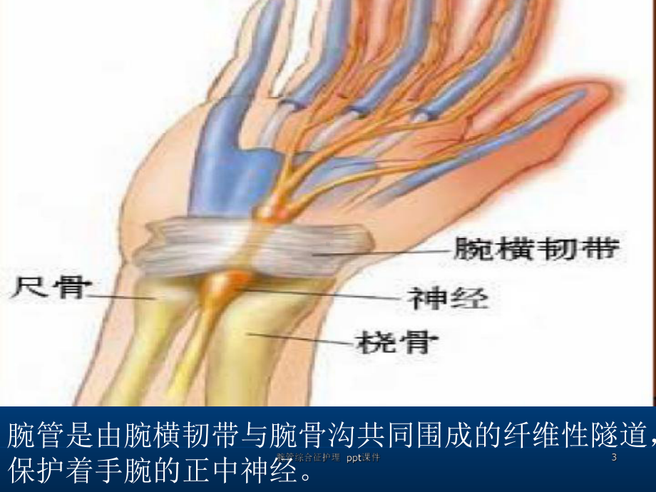 腕管综合征护理-ppt课件.ppt_第3页