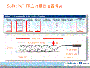 急性缺血性卒中机械取栓流程ppt课件.pptx