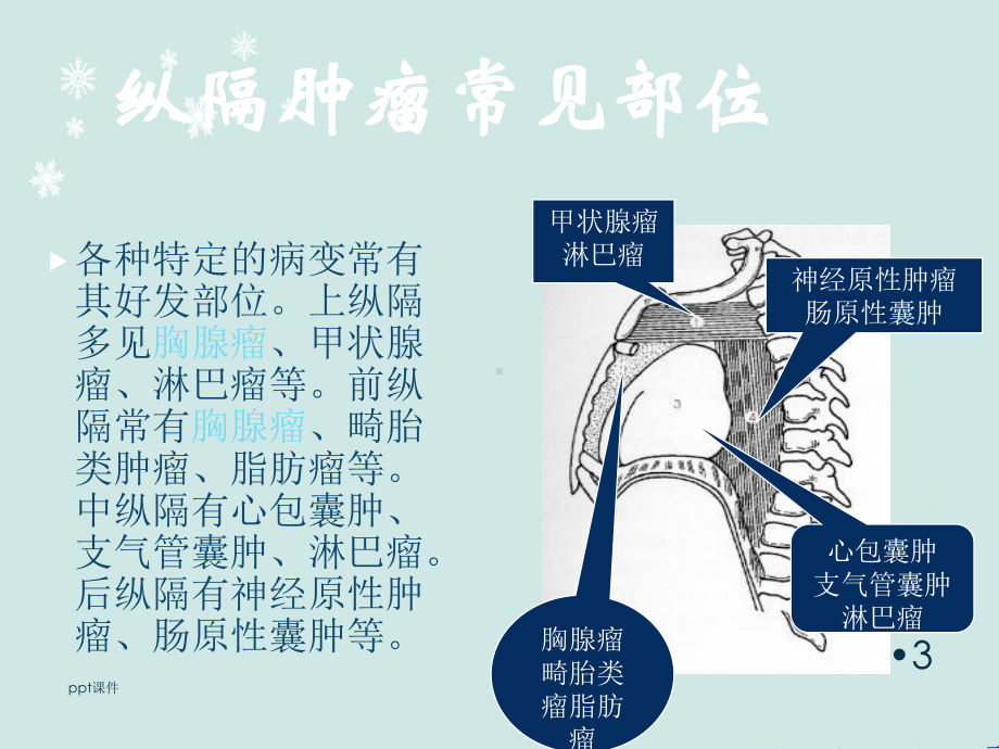 胸腺瘤-ppt课件.ppt_第3页