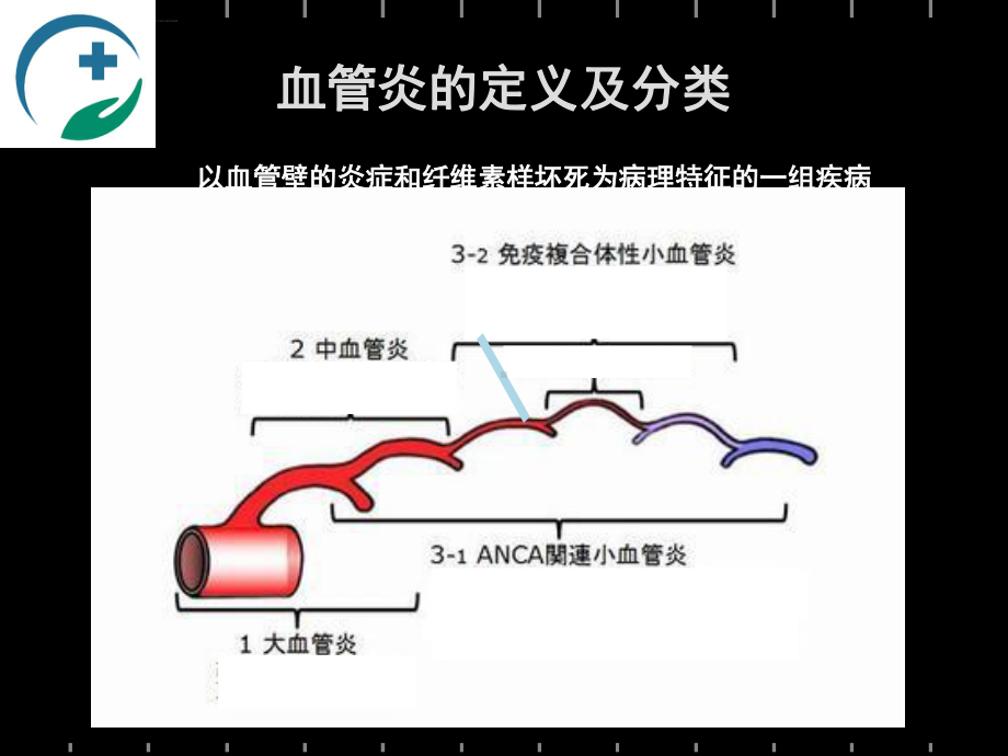 血管炎肾损害的诊断和治疗课件.ppt_第3页